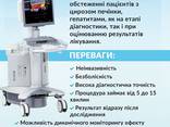 Эластография печени сдвиговой волной в Альт-Мед Одесса - фото 1