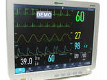 Монитор пациента С86 ("Биомед" ВМ800D 15") - фото 1