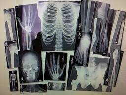 Рентгеновская пленка, б/у