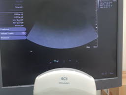 УЗИ узд датчик siemens acuson 4c1 датчик