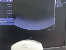 УЗИ узд датчик siemens acuson 6c2 датчик